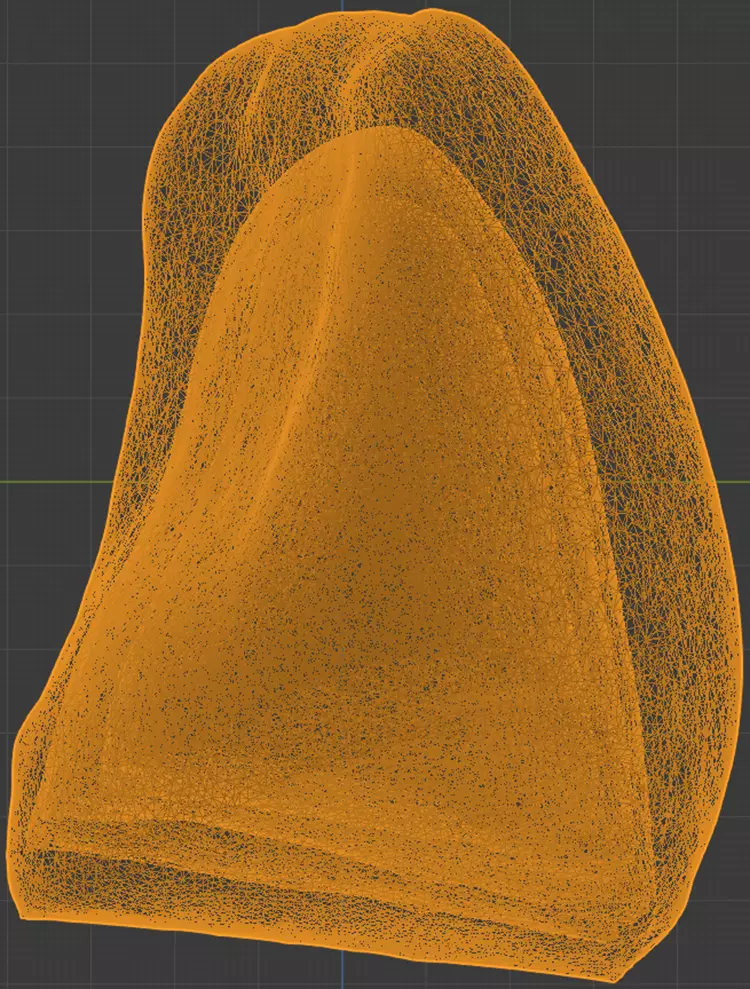 Abb. 1b: Aus Einzelscans ineinander geschachteltes Dreiecksnetz. Scan des Zahnstumpfes als innerste Oberfläche; Scan des darüberliegenden Käppchens als zweite Schicht und das Käppchen mit aufgebrachtem Liner als dritte Schicht (hauchdünn). Die äußere Schicht (dicke Schichtstärke) wurde aus dem Scan, bei dem die aufgetragene Dentin-Schmelz-Schicht nach dem Brand vermessen wurde, erzeugt.