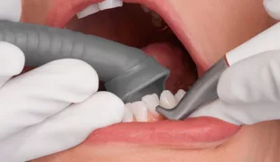 .