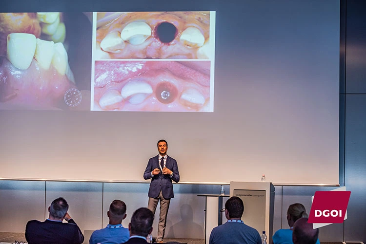 Mit dem portugiesischen Spezialisten Dr. Luis Bessa aus Porto ging es um Sofortimplantate in kompromittierten Extraktionsalveolen und die Frage, wie weit man gehen könne.