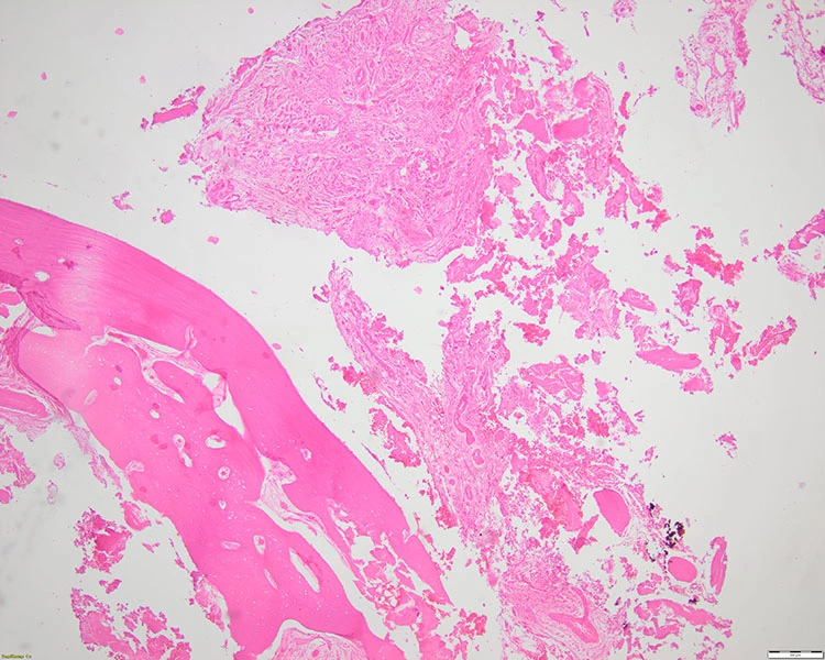 Abb. 21b: Histologie.