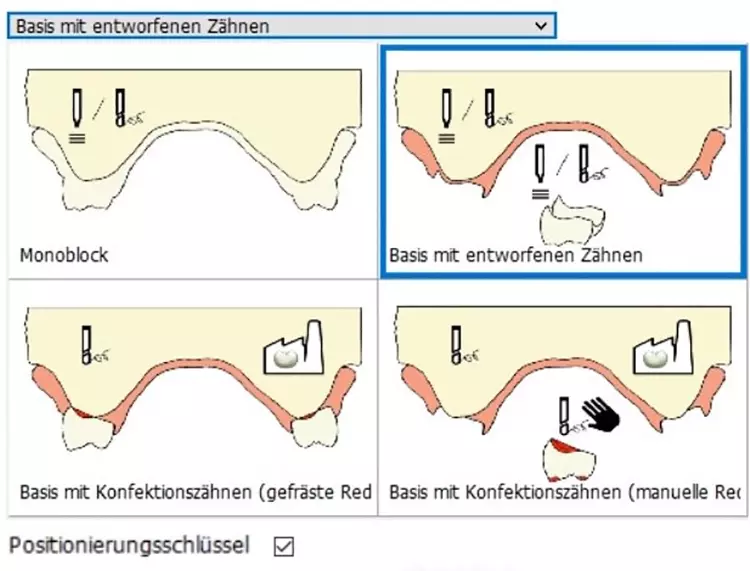 Abb. 22: Im 3Shape Control Panel kann der Positionierungsschlüssel zusätzlich
mit ausgegeben werden.