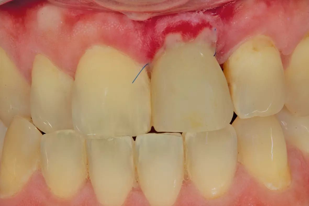 Abb. 22: Farbwahl mit dem PolarEyes-Filter.