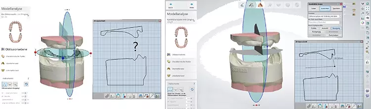 Abb. 25: Selbst konzipierte Okklusionsebene als stl-Datensatz.