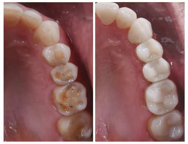 Abb. 26: Vergleich Ausgangssituation und Endergebnis.