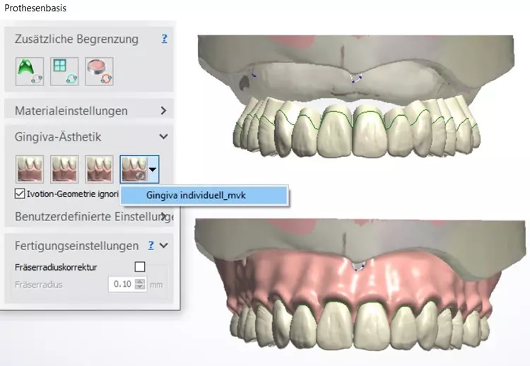 Abb. 28: Im Gingiva-Design erscheinen die konfigurierten Einstellungen (durch Klicken auf Vorschau sichtbar).