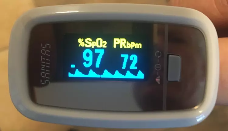 2: Pulsoxymeter.