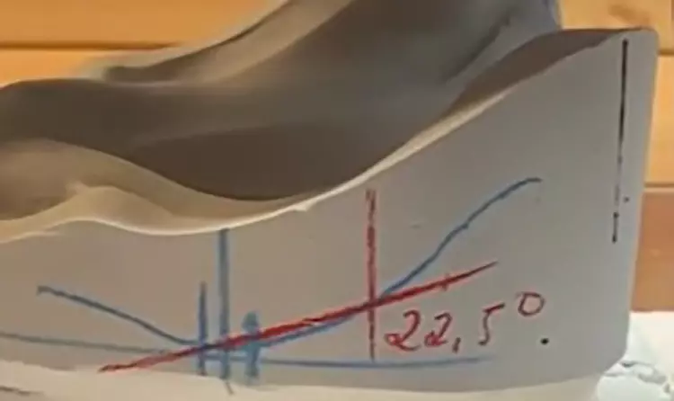 Abb. 3: Modellanalyse mit Bissnahme.