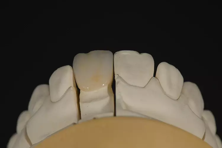 Abb. 33: Ergebnis nach dem Brennvorgang.