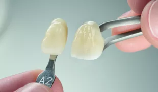 3M Lava Esthetic Fluoreszierendes Vollzirkoniumoxid basiert auf patentierter Färbetechnologie und wurde für eine exakte Übereinstimmung mit den VITA classical Farben entwickelt.