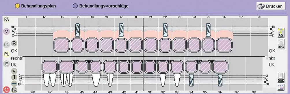 Abb. 3: Mit dem Patienten besprochene Behandlungsplanung.