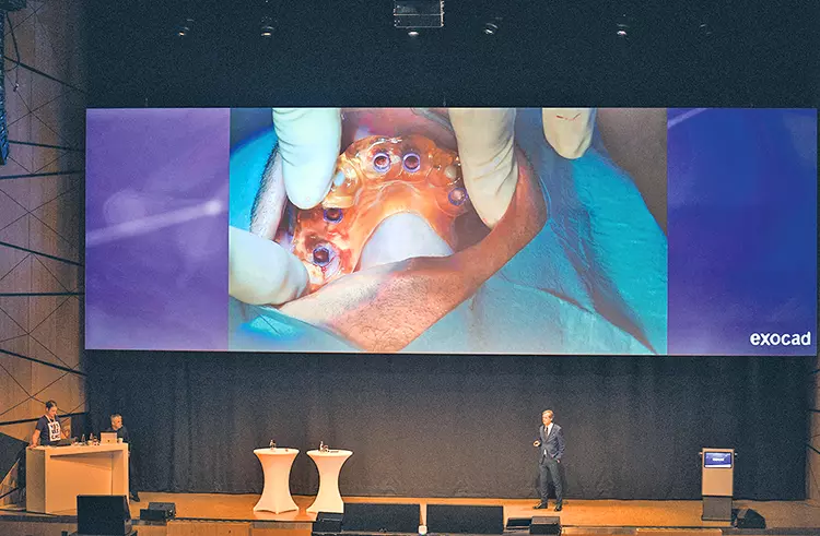 Uli Hauschild zeigte mit Dr. Michael Berthold die Implantatplanung und das Designen der Prothetik am Beispiel eines Patientenfalls mit Live-OP.
