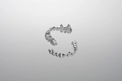 Brücken auf mehrfachen Implantaten.