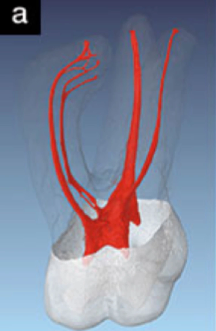 Abb. 3: OK-Molar-Anatomie (mit freundlicher Genehmigung Dr. Frank Paque).
