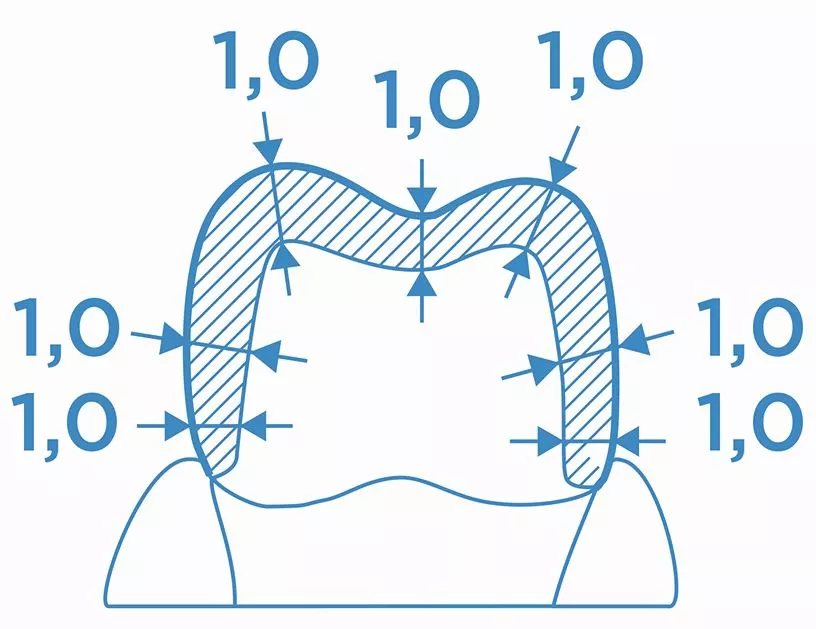 Abb. 3a: Die vorgegebenen Mindestwandstärken für die adhäsive Befestigung.