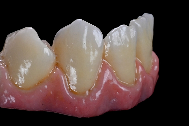 Perfect bemalte Brücke mit glänzenden Effekten.