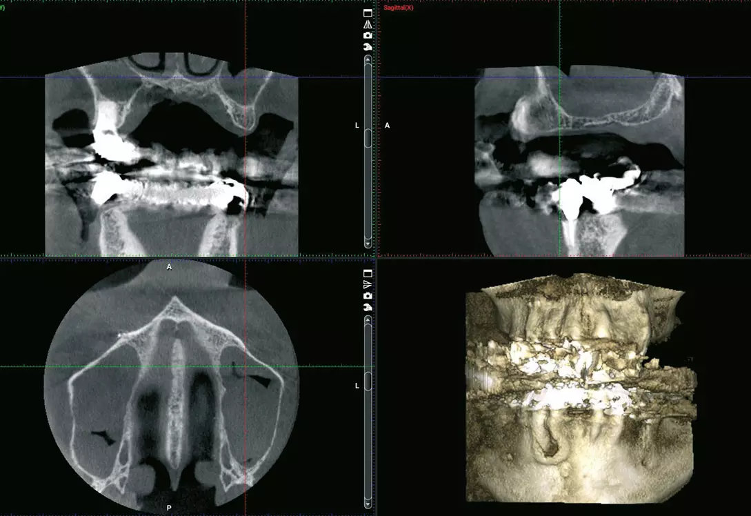 Abb. 4: Start der implantologischen Planung (hier mit DVT), Fotostatus und digitaler Abformung.