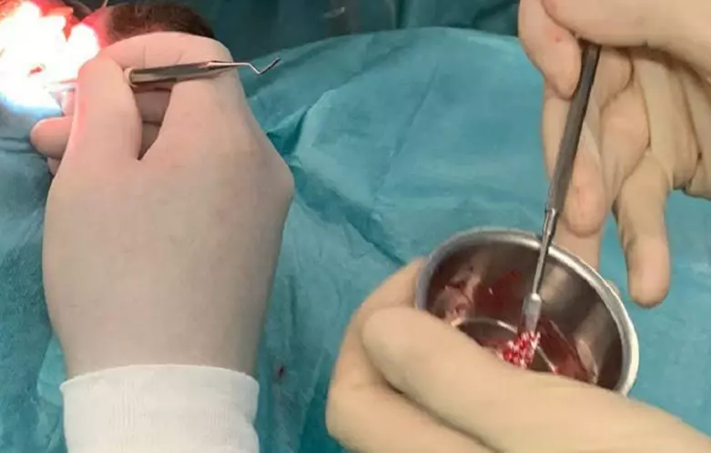 Mit der Teilnahme an einer Live-OP in der Göttinger Zahnarztpraxis von Dr. Stefan Möller schließt das Curriculum Implantologie des DZOI ab. © DZOI