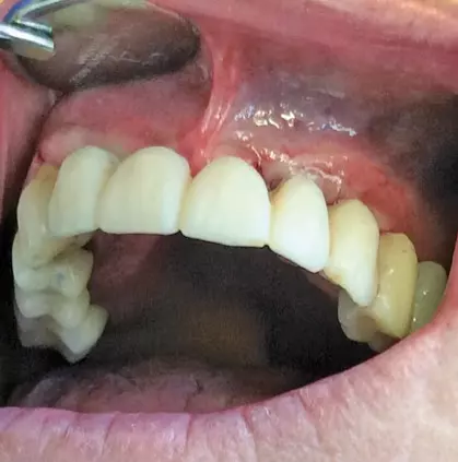 Abb. 4d: Provisorium am Ende der Sitzung.