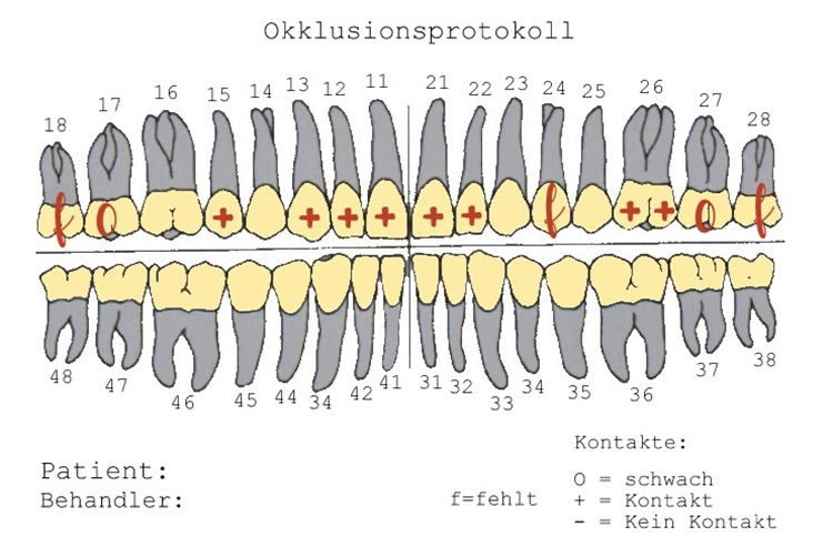 Abb. 5: Ausgefülltes Okklusionsprotokoll vom Zahnarzt.