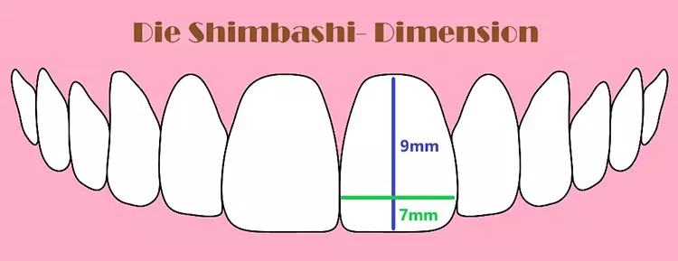 Abb. 6: Größenbestimmung
berechnet nach Shimbashi Dimension.