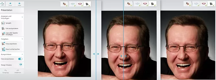 Abb. 7: 3Shape Unite „Smile Design“: Beispiele „vorher/nachher“.