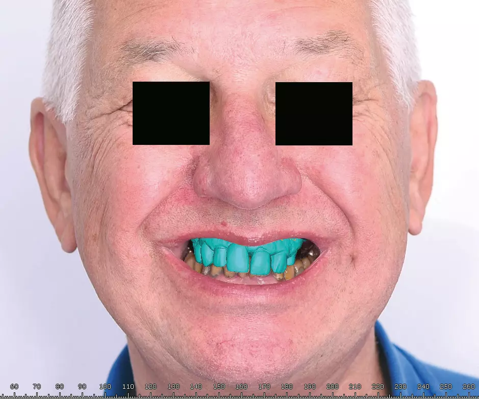 Abb. 7c: Überlagerung des Ausgangsfotos mit dem digitalen Scan der Ausgangssituation.