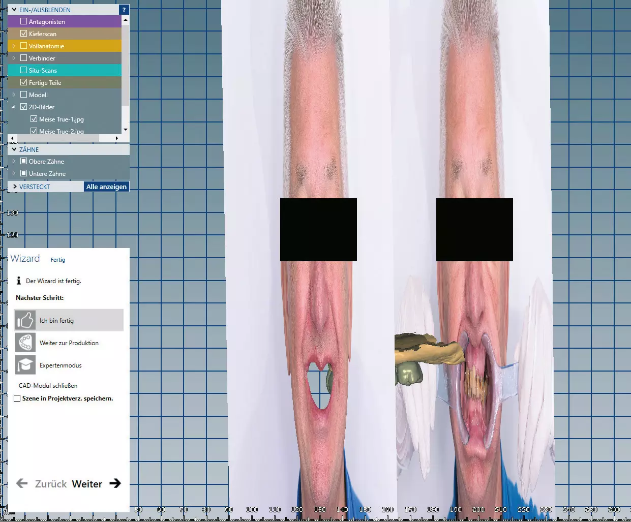 Abb. 7f: 3D-Rotation der einzelnen Bilder zum besseren Verständnis der Überlagerung der einzelnen Daten.