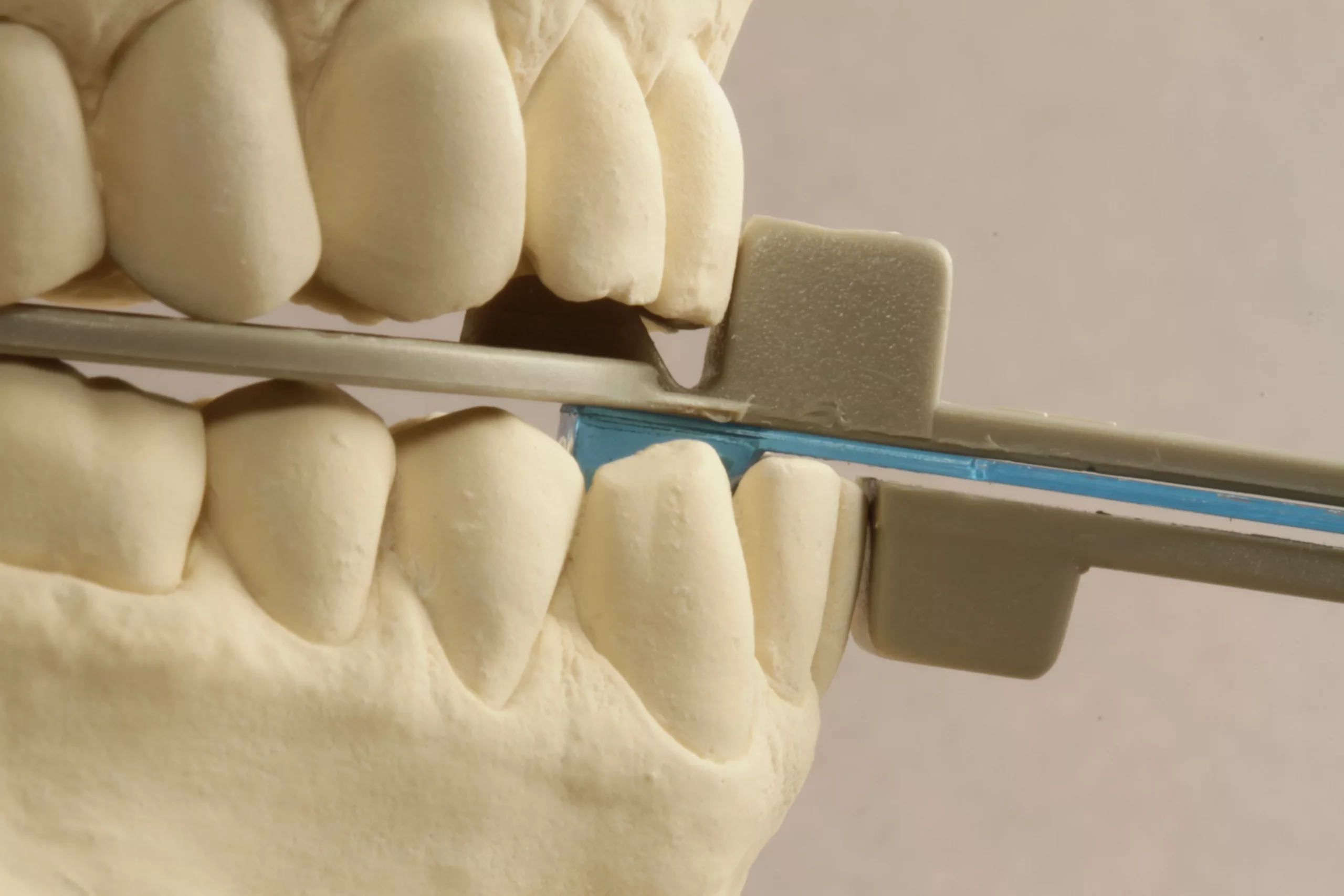 Abb. 8: Maximale Protrusion.