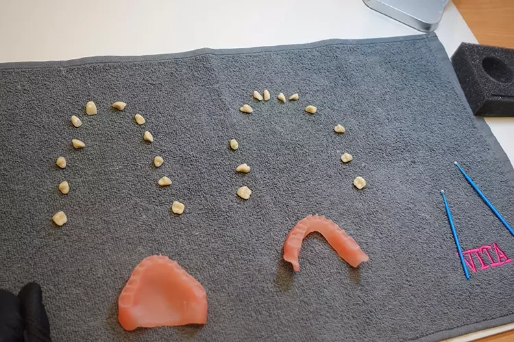 Abb. 9: Schön aufgereihte Zähne, fertig zum Verkleben.