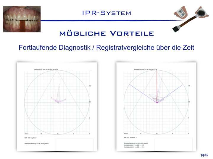 Abb. 8: Ein großer Vorteil des elektronischen Verfahrens ist die Möglichkeit der fortlaufenden Diagnostik und des longitudinalen Vergleichs.