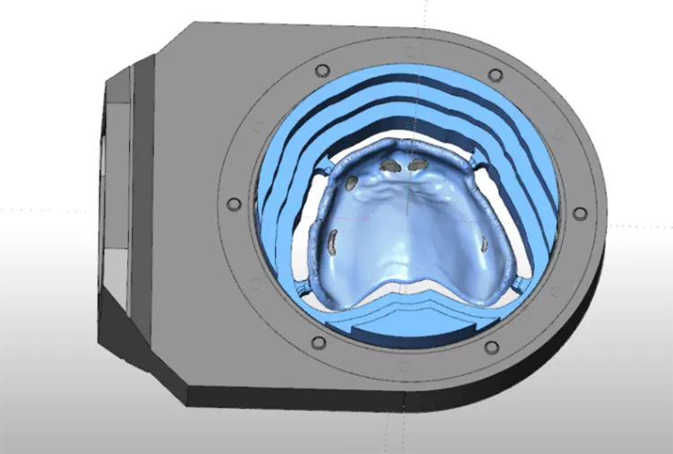 Abb. 9: Fräsvorgang für die Prothesenunterseite wird initiiert.