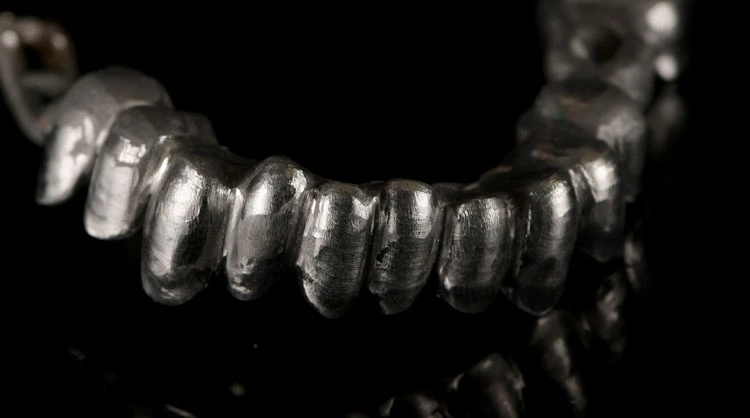 Abb. 9: Das Metallgerüst.