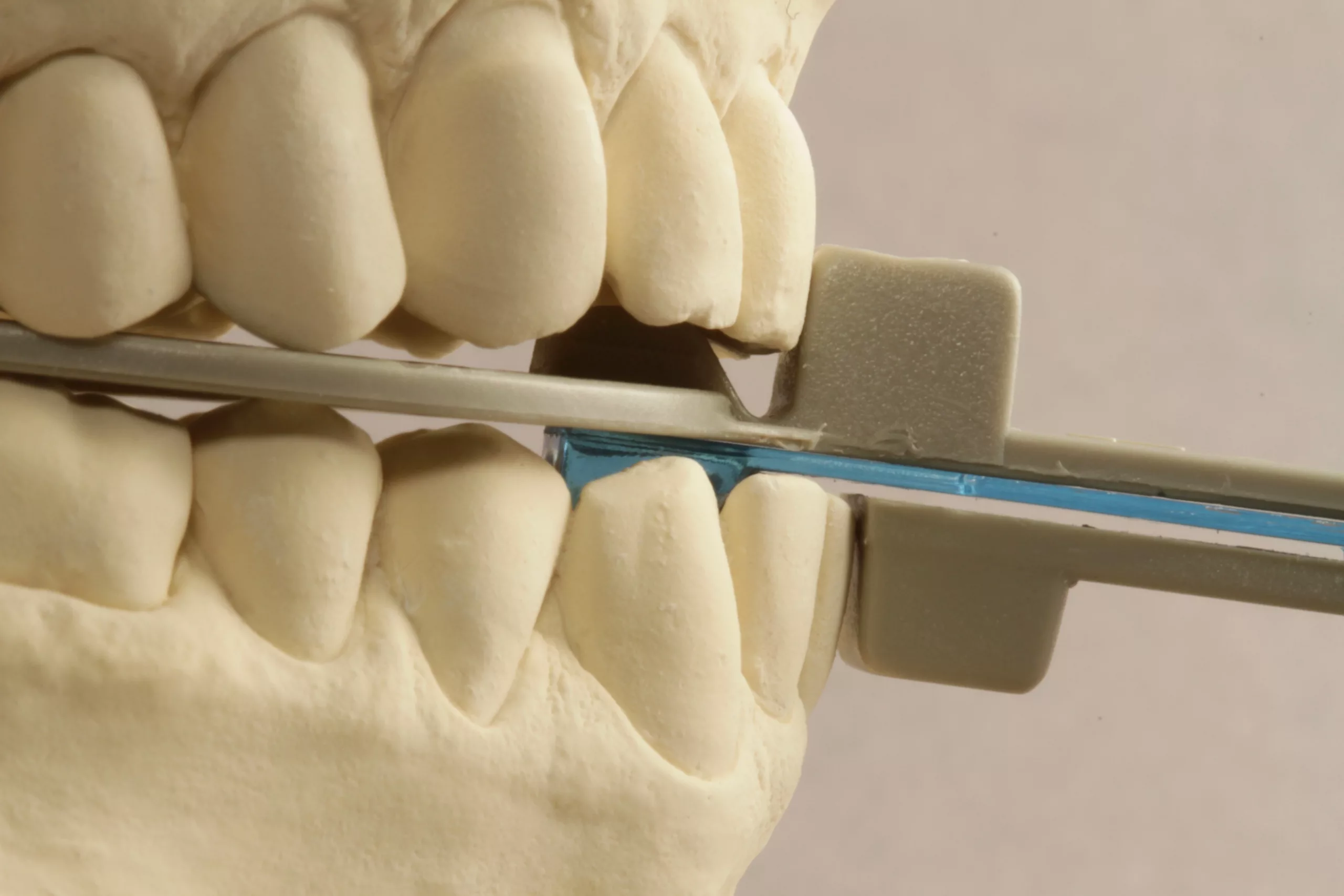 Abb. 9: Therapeutische Protrusion.