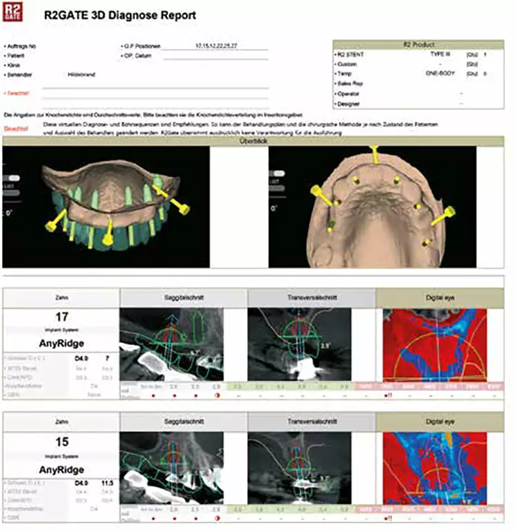 Abb. 9b: Auszug aus dem 3D-Planungsbericht.
