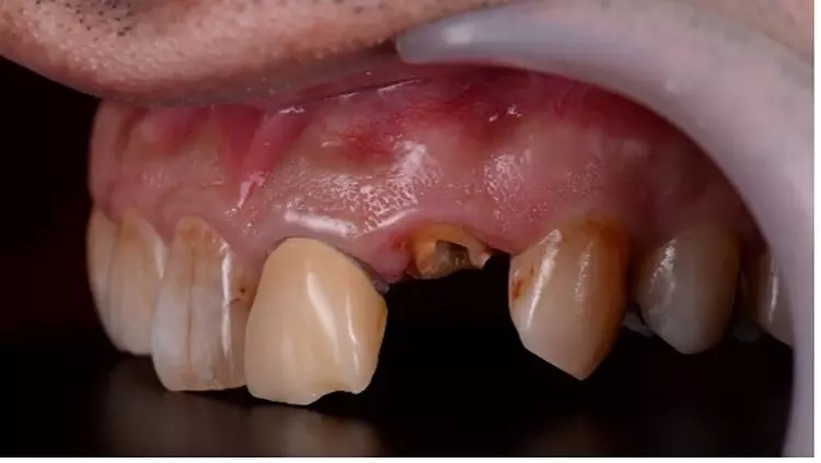 Abb. 1: Ausgangssituation.