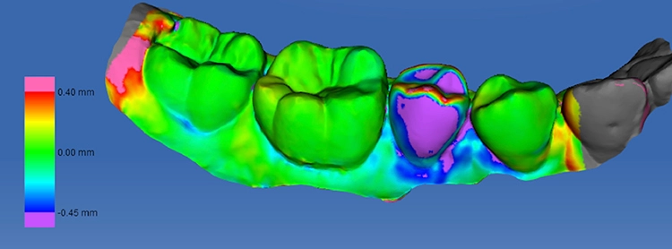 Anwendung und Möglichkeiten des Dynamischen Digitalen Modells, vorgestellt auf der „Dentale SynOptic der AG DDM – Symposium der digitalen Zukunft“ vom 17. – 19. November 2022 in der DDA Berlin.