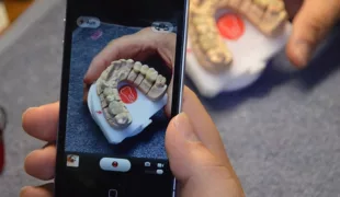 Der Videopreis der AG Keramik wird seit 2012 für Kurzfilme vergeben, die Anregungen, Arbeitsschritte sowie Tipps bei der Restauration aus Keramik oder Hybrid-Werkstoffen zeigen. Bis 30. Juni nimmt die AGK-Geschäftsstelle Bewerbungen entgegen.