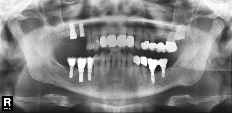 Abb. 2: Radiologischer Befund im Jahr 2010.