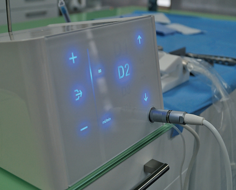 Abb. 4: Schonende Extraktion des Zahnes 12 mittels Ultraschallchirurgie.