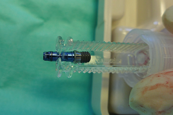 Abb. 29: Es wurden Implantate von Straumann eingesetzt – im Bild 4 mm.