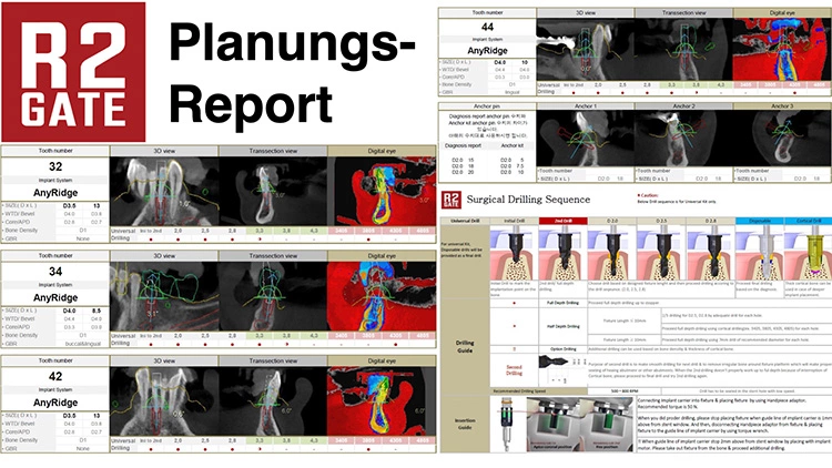 Abb. 2b: … 3D-Planung (R2GATE)…