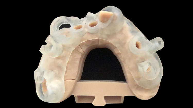Abb. 2c: … bis hin zur 3D-Guide Schablone.