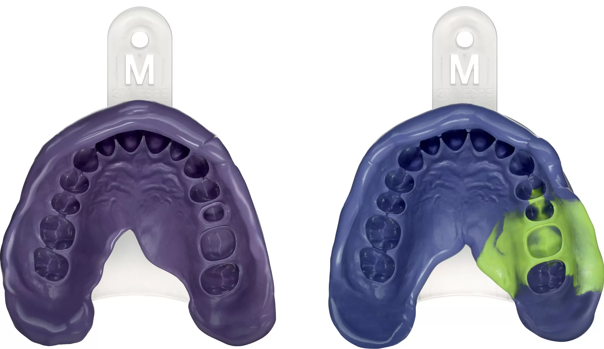 Von Anwendern empfohlen: 3M Impregum Super Quick Polyether Abformmaterial (links: Monophasentechnik mit Medium Body, rechts: Doppelmischtechnik mit Heavy Body und Light Body Material).