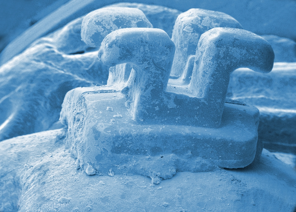 Brackets bieten bakteriellem Biofilm ideale Retentionsnischen. (REM-Aufnahme: Prof. Dr. S. Kneist)