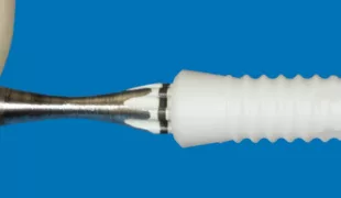 Keramikimplantat.