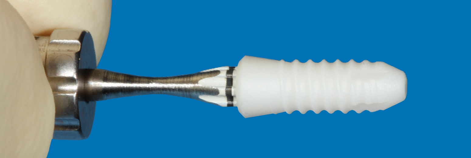Keramikimplantat.