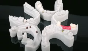Implantatmodelle