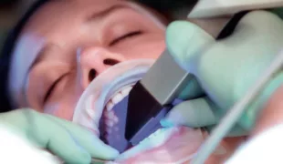 Die Intraoralaufnahme erfasst im Ganzkiefer-Scan die okklusale Funktion, die Bissverhältnisse mit Centric Guide sowie mittels Bissregistrat die realdynamischen Bewegungen zur Verarbeitung im virtuellen Artikulator.