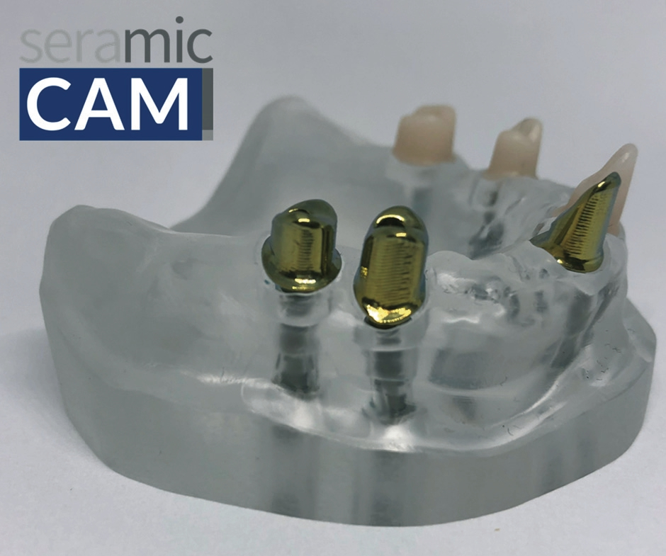Beispielarbeit von seramicCAM