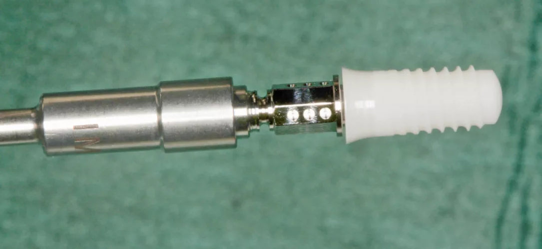 Abb. 1: Das Straumann® PURE Ceramic Implantat.